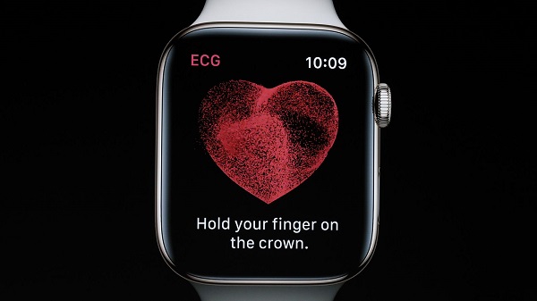 Apple Watch EKG