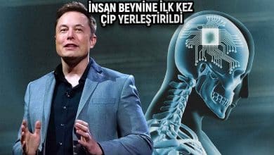 Elon Musk Neuralink