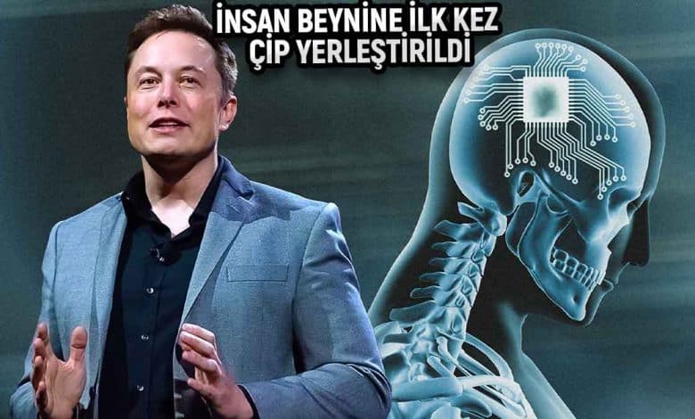 Elon Musk Neuralink