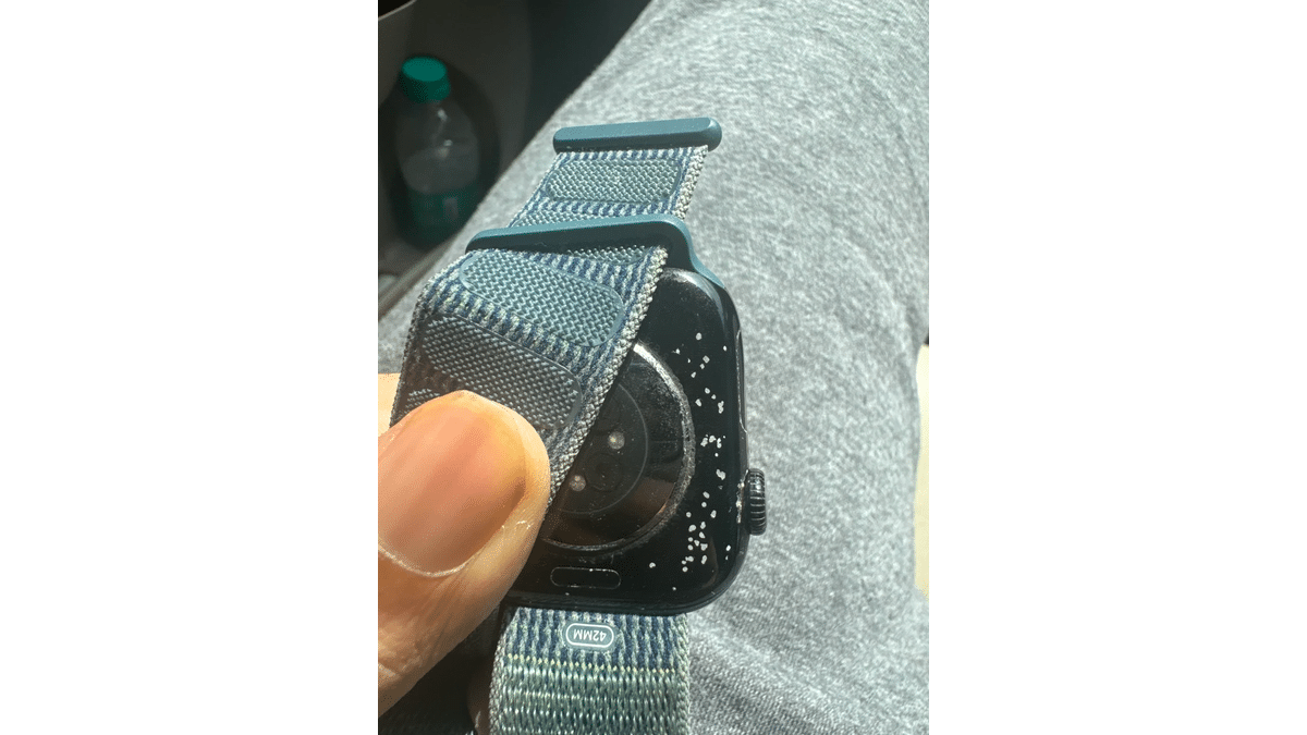 Apple Watch 10’da Sorun Var, Apple Ücretsiz Değiştiriyor!